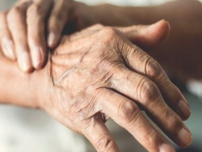 ابتلا به پارکینسون در ایران ۴۰درصد بیشتر از میانگین جهانی